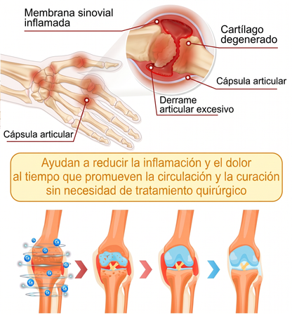 30 % de descuento 🎁🎁 | Crema 𝐌𝐔𝐑𝐖𝐎𝐍® con veneno de abeja para aliviar el dolor y favorecer el bienestar de las articulaciones ✨✨✨ (Especialmente para adultos mayores)