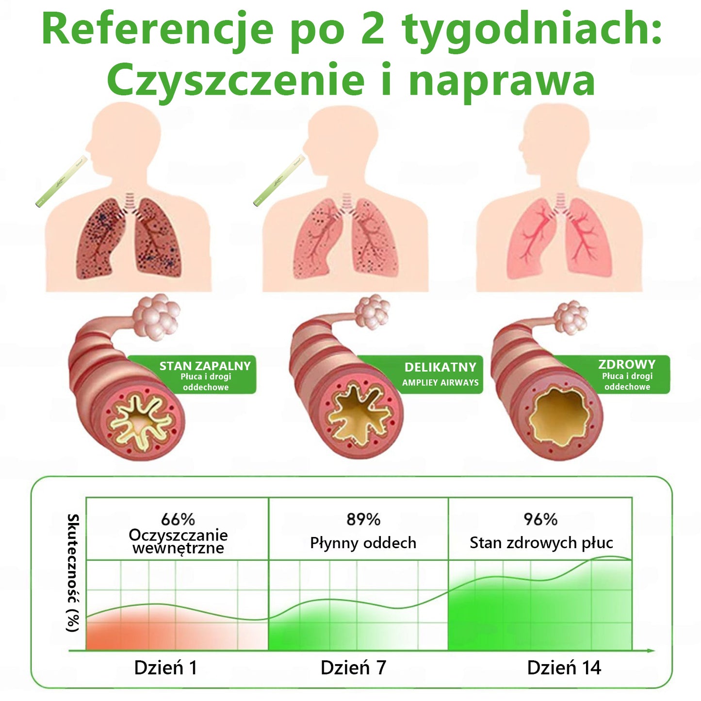 🇵🇱 𝐖𝐲𝐬𝐨𝐤𝐢𝐞𝐣 𝐣𝐚𝐤𝐨ś𝐜𝐢 𝐩𝐨𝐥𝐬𝐤𝐢 𝐩𝐫𝐨𝐝𝐮𝐤𝐭, 𝒘𝒚𝒔𝒚ł𝒌𝒂 𝒛 𝒌𝒓𝒂𝒋𝒖✅𝐙𝐢𝐨ł𝐨𝐰𝐲 𝐰𝐚𝐩𝐨𝐫𝐲𝐳𝐚𝐭𝐨𝐫 𝐝𝐨 𝐩ł𝐮𝐜 𝐌𝐮𝐫𝐰𝐨𝐧® (👨‍⚕️ 𝐒𝐤𝐮𝐭𝐞𝐜𝐳𝐧𝐲 𝐧𝐚: 𝐤𝐚𝐬𝐳𝐞𝐥, 𝐝𝐮𝐬𝐳𝐧𝐨ś𝐜𝐢, 𝐟𝐥𝐞𝐠𝐦ę, 𝐳𝐚𝐭𝐤𝐚𝐧𝐲 𝐧𝐨𝐬, 𝐳𝐚𝐩𝐚𝐥𝐞𝐧𝐢𝐞 𝐨𝐬𝐤𝐫𝐳𝐞𝐥𝐢, 𝐚𝐥𝐞𝐫𝐠𝐢ę 𝐢 𝐩𝐫𝐨𝐛𝐥𝐞𝐦𝐲 𝐳 𝐩ł𝐮𝐜𝐚𝐦𝐢)4💖