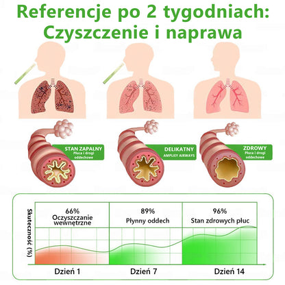 🇵🇱 𝐖𝐲𝐬𝐨𝐤𝐢𝐞𝐣 𝐣𝐚𝐤𝐨ś𝐜𝐢 𝐩𝐨𝐥𝐬𝐤𝐢 𝐩𝐫𝐨𝐝𝐮𝐤𝐭, 𝒘𝒚𝒔𝒚ł𝒌𝒂 𝒛 𝒌𝒓𝒂𝒋𝒖✅𝐙𝐢𝐨ł𝐨𝐰𝐲 𝐰𝐚𝐩𝐨𝐫𝐲𝐳𝐚𝐭𝐨𝐫 𝐝𝐨 𝐩ł𝐮𝐜 𝐌𝐮𝐫𝐰𝐨𝐧® (👨‍⚕️ 𝐒𝐤𝐮𝐭𝐞𝐜𝐳𝐧𝐲 𝐧𝐚: 𝐤𝐚𝐬𝐳𝐞𝐥, 𝐝𝐮𝐬𝐳𝐧𝐨ś𝐜𝐢, 𝐟𝐥𝐞𝐠𝐦ę, 𝐳𝐚𝐭𝐤𝐚𝐧𝐲 𝐧𝐨𝐬, 𝐳𝐚𝐩𝐚𝐥𝐞𝐧𝐢𝐞 𝐨𝐬𝐤𝐫𝐳𝐞𝐥𝐢, 𝐚𝐥𝐞𝐫𝐠𝐢ę 𝐢 𝐩𝐫𝐨𝐛𝐥𝐞𝐦𝐲 𝐳 𝐩ł𝐮𝐜𝐚𝐦𝐢)4💖