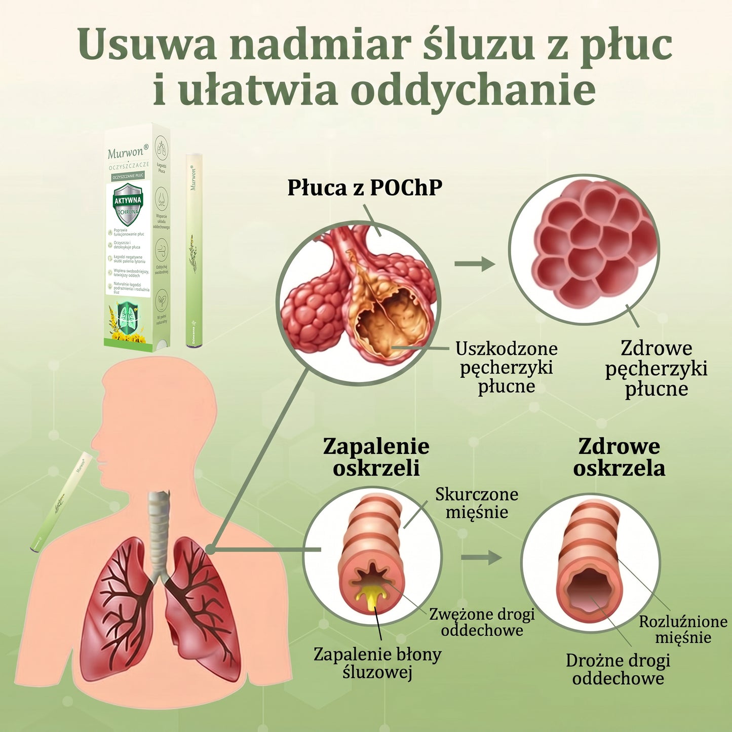 🇵🇱 𝐖𝐲𝐬𝐨𝐤𝐢𝐞𝐣 𝐣𝐚𝐤𝐨ś𝐜𝐢 𝐩𝐨𝐥𝐬𝐤𝐢 𝐩𝐫𝐨𝐝𝐮𝐤𝐭, 𝒘𝒚𝒔𝒚ł𝒌𝒂 𝒛 𝒌𝒓𝒂𝒋𝒖✅𝐙𝐢𝐨ł𝐨𝐰𝐲 𝐰𝐚𝐩𝐨𝐫𝐲𝐳𝐚𝐭𝐨𝐫 𝐝𝐨 𝐩ł𝐮𝐜 𝐌𝐮𝐫𝐰𝐨𝐧® (👨‍⚕️ 𝐒𝐤𝐮𝐭𝐞𝐜𝐳𝐧𝐲 𝐧𝐚: 𝐤𝐚𝐬𝐳𝐞𝐥, 𝐝𝐮𝐬𝐳𝐧𝐨ś𝐜𝐢, 𝐟𝐥𝐞𝐠𝐦ę, 𝐳𝐚𝐭𝐤𝐚𝐧𝐲 𝐧𝐨𝐬, 𝐳𝐚𝐩𝐚𝐥𝐞𝐧𝐢𝐞 𝐨𝐬𝐤𝐫𝐳𝐞𝐥𝐢, 𝐚𝐥𝐞𝐫𝐠𝐢ę 𝐢 𝐩𝐫𝐨𝐛𝐥𝐞𝐦𝐲 𝐳 𝐩ł𝐮𝐜𝐚𝐦𝐢)4💖