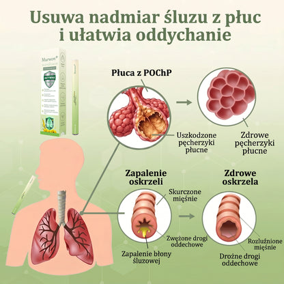 🇵🇱 𝐖𝐲𝐬𝐨𝐤𝐢𝐞𝐣 𝐣𝐚𝐤𝐨ś𝐜𝐢 𝐩𝐨𝐥𝐬𝐤𝐢 𝐩𝐫𝐨𝐝𝐮𝐤𝐭, 𝒘𝒚𝒔𝒚ł𝒌𝒂 𝒛 𝒌𝒓𝒂𝒋𝒖✅𝐙𝐢𝐨ł𝐨𝐰𝐲 𝐰𝐚𝐩𝐨𝐫𝐲𝐳𝐚𝐭𝐨𝐫 𝐝𝐨 𝐩ł𝐮𝐜 𝐌𝐮𝐫𝐰𝐨𝐧® (👨‍⚕️ 𝐒𝐤𝐮𝐭𝐞𝐜𝐳𝐧𝐲 𝐧𝐚: 𝐤𝐚𝐬𝐳𝐞𝐥, 𝐝𝐮𝐬𝐳𝐧𝐨ś𝐜𝐢, 𝐟𝐥𝐞𝐠𝐦ę, 𝐳𝐚𝐭𝐤𝐚𝐧𝐲 𝐧𝐨𝐬, 𝐳𝐚𝐩𝐚𝐥𝐞𝐧𝐢𝐞 𝐨𝐬𝐤𝐫𝐳𝐞𝐥𝐢, 𝐚𝐥𝐞𝐫𝐠𝐢ę 𝐢 𝐩𝐫𝐨𝐛𝐥𝐞𝐦𝐲 𝐳 𝐩ł𝐮𝐜𝐚𝐦𝐢)4💖