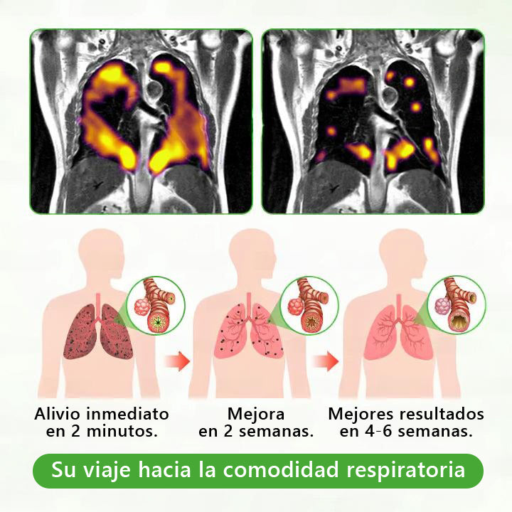 𝐓𝐢𝐞𝐧𝐝𝐚 𝐨𝐟𝐢𝐜𝐢𝐚𝐥 ✨𝐌𝐮𝐫𝑤𝗈𝒏® Difusor Botánico de Mullein para Limpieza de Pulmones (🫁 Tos, faringitis, dificultad para respirar, flema, congestión nasal, bronquitis, síntomas alérgicos, malestar pulmonar)5💖