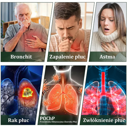 🇵🇱 𝐖𝐲𝐬𝐨𝐤𝐢𝐞𝐣 𝐣𝐚𝐤𝐨ś𝐜𝐢 𝐩𝐨𝐥𝐬𝐤𝐢 𝐩𝐫𝐨𝐝𝐮𝐤𝐭, 𝒘𝒚𝒔𝒚ł𝒌𝒂 𝒛 𝒌𝒓𝒂𝒋𝒖✅𝐙𝐢𝐨ł𝐨𝐰𝐲 𝐰𝐚𝐩𝐨𝐫𝐲𝐳𝐚𝐭𝐨𝐫 𝐝𝐨 𝐩ł𝐮𝐜 𝐌𝐮𝐫𝐰𝐨𝐧® (👨‍⚕️ 𝐒𝐤𝐮𝐭𝐞𝐜𝐳𝐧𝐲 𝐧𝐚: 𝐤𝐚𝐬𝐳𝐞𝐥, 𝐝𝐮𝐬𝐳𝐧𝐨ś𝐜𝐢, 𝐟𝐥𝐞𝐠𝐦ę, 𝐳𝐚𝐭𝐤𝐚𝐧𝐲 𝐧𝐨𝐬, 𝐳𝐚𝐩𝐚𝐥𝐞𝐧𝐢𝐞 𝐨𝐬𝐤𝐫𝐳𝐞𝐥𝐢, 𝐚𝐥𝐞𝐫𝐠𝐢ę 𝐢 𝐩𝐫𝐨𝐛𝐥𝐞𝐦𝐲 𝐳 𝐩ł𝐮𝐜𝐚𝐦𝐢)4💖
