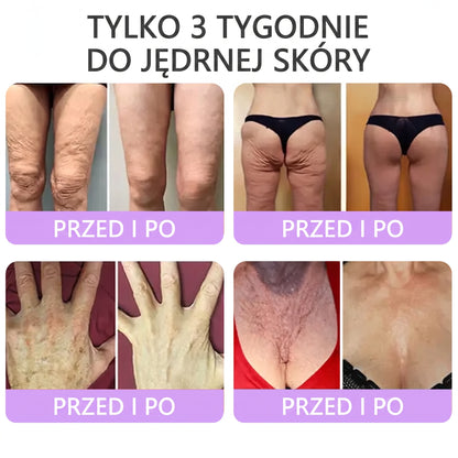 Polecany przez dermatologów🥇 |🍇 Vitalisys® PDRN Multi-Peptide Masujący Krem do Ciała – przeciwstarzeniowy, nawilżający, ujędrniający, regenerujący, wyrównujący koloryt, redukuje trądzik, przebarwienia, brodawki, znamiona i łuszczycę.❤️
