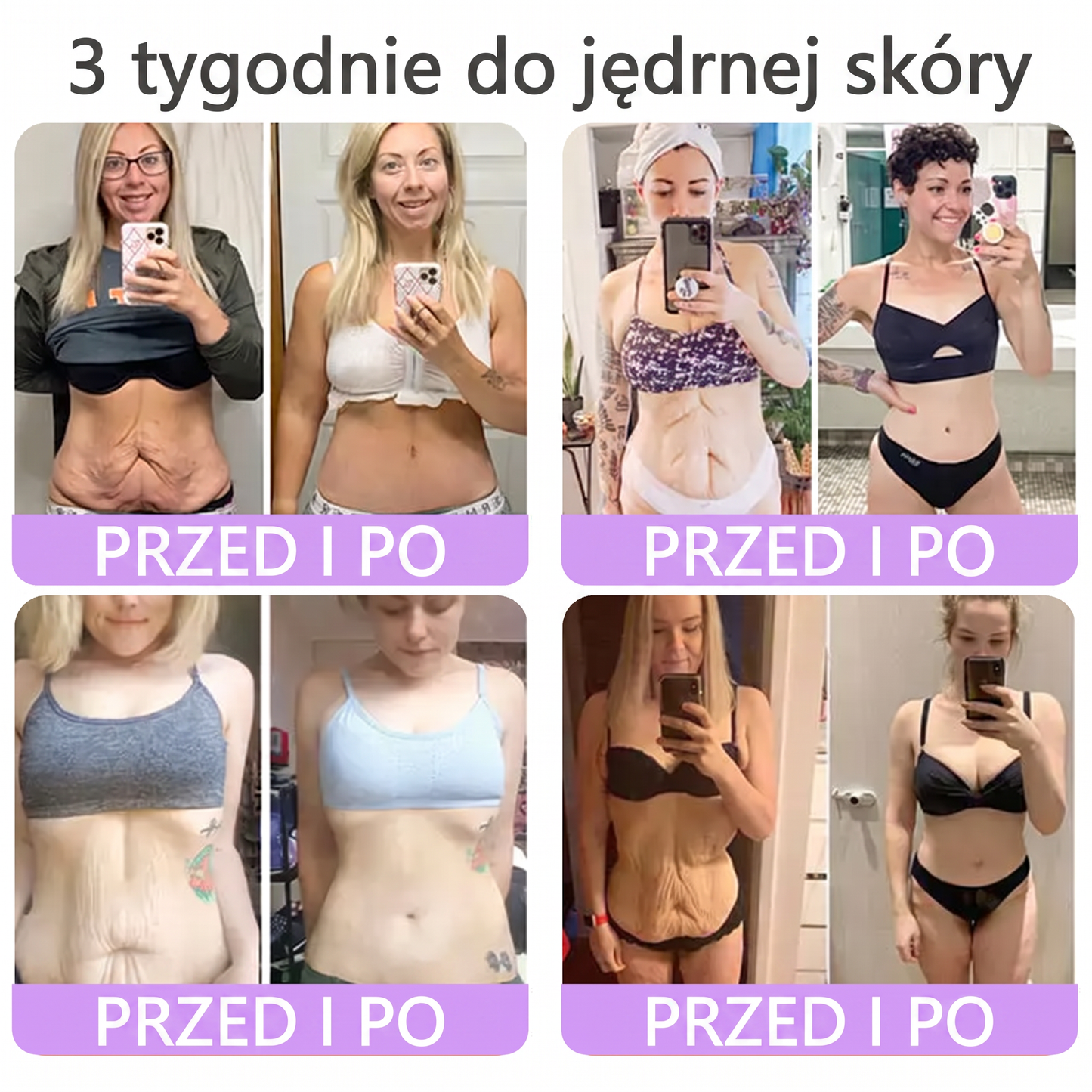 Polecany przez dermatologów🥇 |🍇 Vitalisys® PDRN Multi-Peptide Masujący Krem do Ciała – przeciwstarzeniowy, nawilżający, ujędrniający, regenerujący, wyrównujący koloryt, redukuje trądzik, przebarwienia, brodawki, znamiona i łuszczycę.❤️