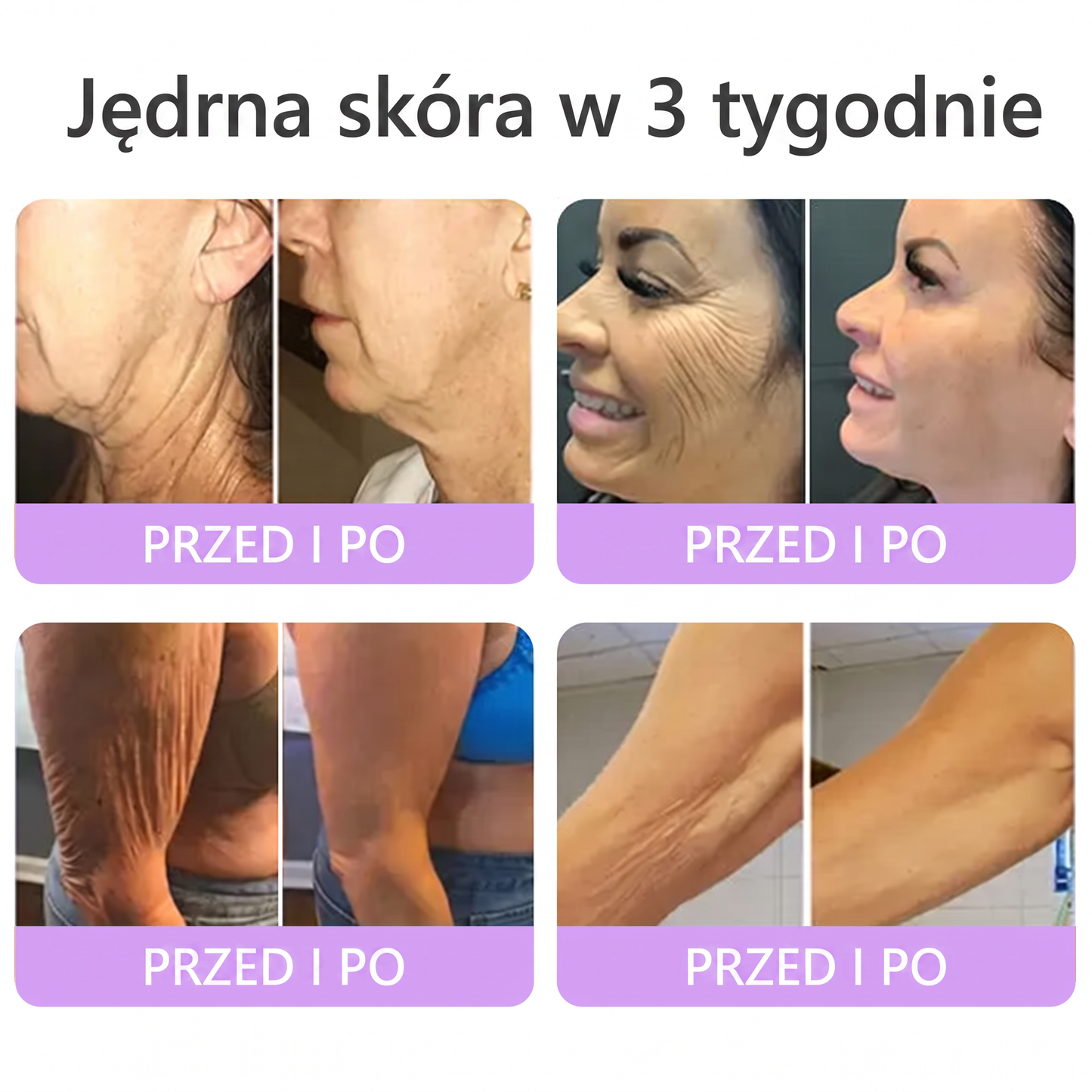 Polecany przez dermatologów🥇 |🍇 Vitalisys® PDRN Multi-Peptide Masujący Krem do Ciała – przeciwstarzeniowy, nawilżający, ujędrniający, regenerujący, wyrównujący koloryt, redukuje trądzik, przebarwienia, brodawki, znamiona i łuszczycę.❤️