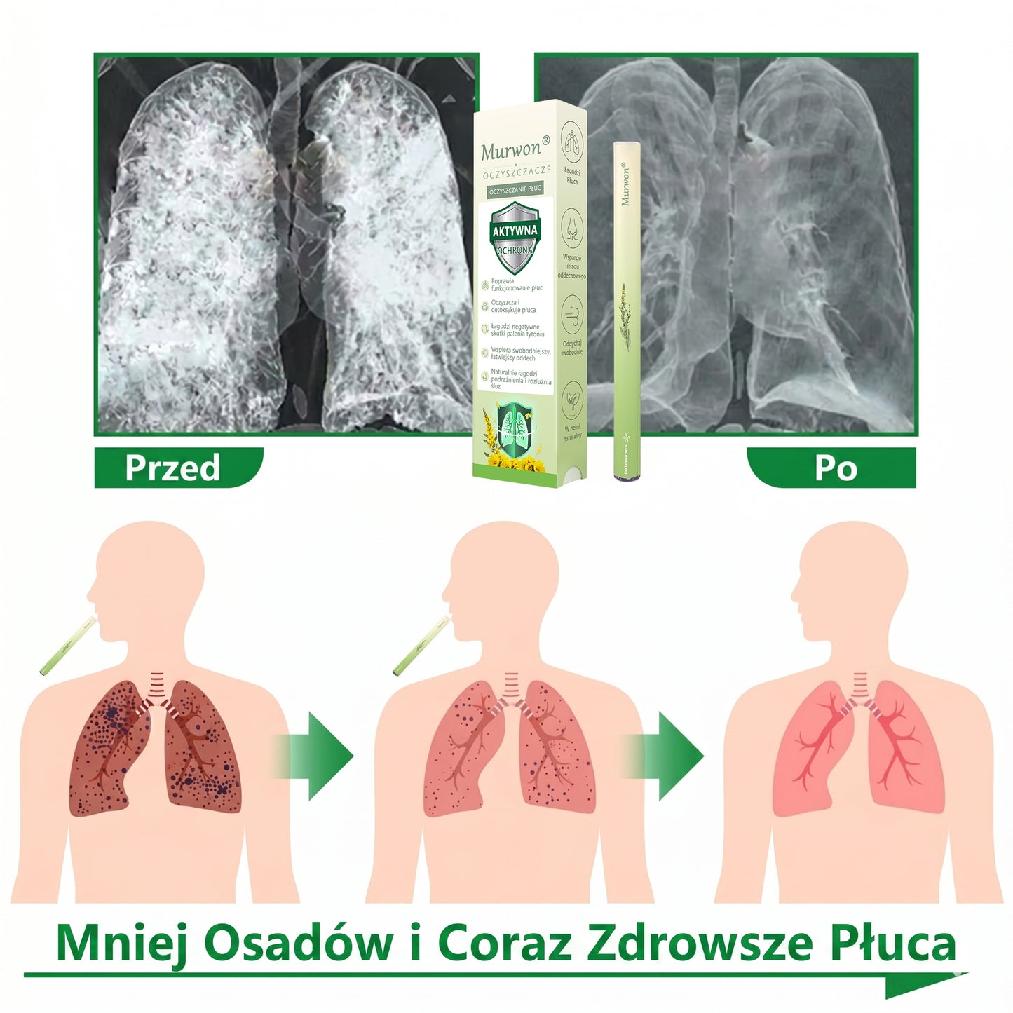 🇵🇱 𝐖𝐲𝐬𝐨𝐤𝐢𝐞𝐣 𝐣𝐚𝐤𝐨ś𝐜𝐢 𝐩𝐨𝐥𝐬𝐤𝐢 𝐩𝐫𝐨𝐝𝐮𝐤𝐭, 𝒘𝒚𝒔𝒚ł𝒌𝒂 𝒛 𝒌𝒓𝒂𝒋𝒖✅𝐙𝐢𝐨ł𝐨𝐰𝐲 𝐰𝐚𝐩𝐨𝐫𝐲𝐳𝐚𝐭𝐨𝐫 𝐝𝐨 𝐩ł𝐮𝐜 𝐌𝐮𝐫𝐰𝐨𝐧® (👨‍⚕️ 𝐒𝐤𝐮𝐭𝐞𝐜𝐳𝐧𝐲 𝐧𝐚: 𝐤𝐚𝐬𝐳𝐞𝐥, 𝐝𝐮𝐬𝐳𝐧𝐨ś𝐜𝐢, 𝐟𝐥𝐞𝐠𝐦ę, 𝐳𝐚𝐭𝐤𝐚𝐧𝐲 𝐧𝐨𝐬, 𝐳𝐚𝐩𝐚𝐥𝐞𝐧𝐢𝐞 𝐨𝐬𝐤𝐫𝐳𝐞𝐥𝐢, 𝐚𝐥𝐞𝐫𝐠𝐢ę 𝐢 𝐩𝐫𝐨𝐛𝐥𝐞𝐦𝐲 𝐳 𝐩ł𝐮𝐜𝐚𝐦𝐢)4💖