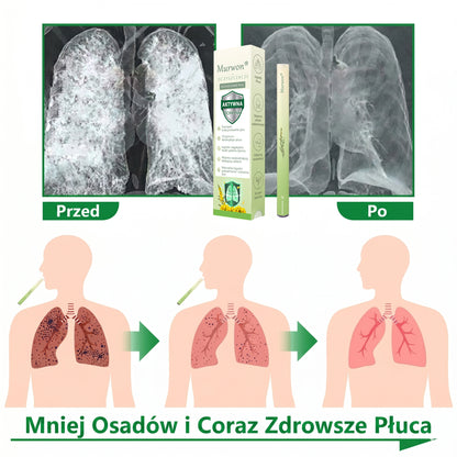🇵🇱 𝐖𝐲𝐬𝐨𝐤𝐢𝐞𝐣 𝐣𝐚𝐤𝐨ś𝐜𝐢 𝐩𝐨𝐥𝐬𝐤𝐢 𝐩𝐫𝐨𝐝𝐮𝐤𝐭, 𝒘𝒚𝒔𝒚ł𝒌𝒂 𝒛 𝒌𝒓𝒂𝒋𝒖✅𝐙𝐢𝐨ł𝐨𝐰𝐲 𝐰𝐚𝐩𝐨𝐫𝐲𝐳𝐚𝐭𝐨𝐫 𝐝𝐨 𝐩ł𝐮𝐜 𝐌𝐮𝐫𝐰𝐨𝐧® (👨‍⚕️ 𝐒𝐤𝐮𝐭𝐞𝐜𝐳𝐧𝐲 𝐧𝐚: 𝐤𝐚𝐬𝐳𝐞𝐥, 𝐝𝐮𝐬𝐳𝐧𝐨ś𝐜𝐢, 𝐟𝐥𝐞𝐠𝐦ę, 𝐳𝐚𝐭𝐤𝐚𝐧𝐲 𝐧𝐨𝐬, 𝐳𝐚𝐩𝐚𝐥𝐞𝐧𝐢𝐞 𝐨𝐬𝐤𝐫𝐳𝐞𝐥𝐢, 𝐚𝐥𝐞𝐫𝐠𝐢ę 𝐢 𝐩𝐫𝐨𝐛𝐥𝐞𝐦𝐲 𝐳 𝐩ł𝐮𝐜𝐚𝐦𝐢)4💖