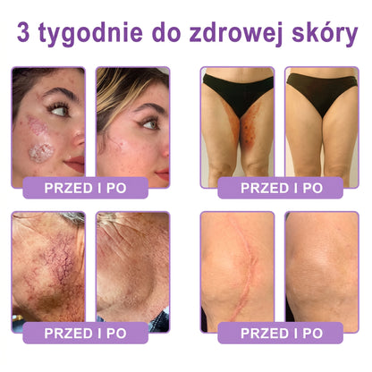 Polecany przez dermatologów🥇 |🍇 Vitalisys® PDRN Multi-Peptide Masujący Krem do Ciała – przeciwstarzeniowy, nawilżający, ujędrniający, regenerujący, wyrównujący koloryt, redukuje trądzik, przebarwienia, brodawki, znamiona i łuszczycę.❤️
