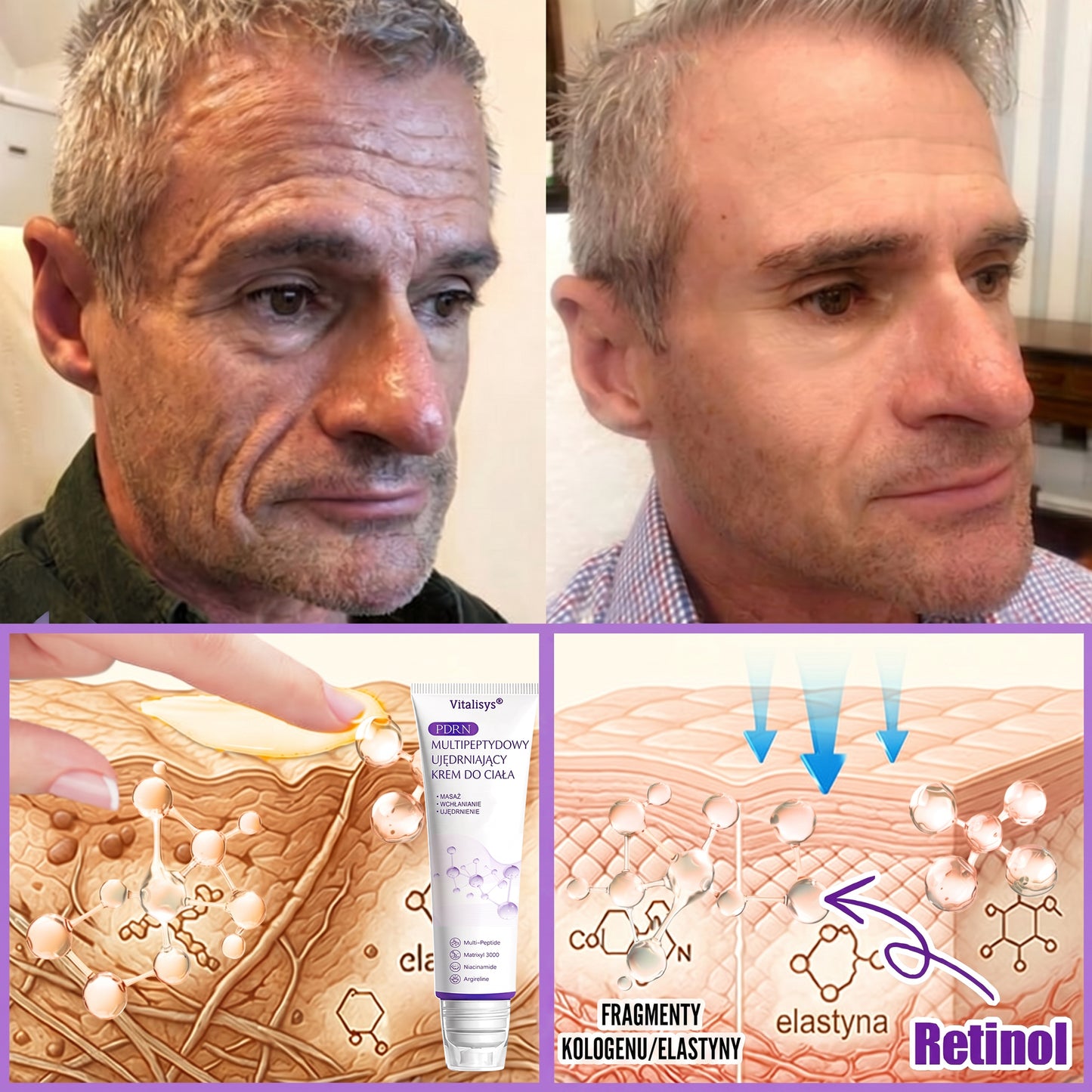 Polecany przez dermatologów🥇 |🍇 Vitalisys® PDRN Multi-Peptide Masujący Krem do Ciała – przeciwstarzeniowy, nawilżający, ujędrniający, regenerujący, wyrównujący koloryt, redukuje trądzik, przebarwienia, brodawki, znamiona i łuszczycę.❤️